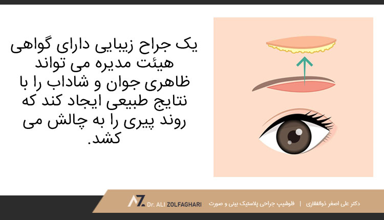 اصلاح افتادگی ابرو با جراحی