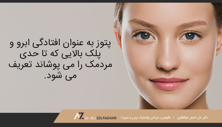 اصلاح افتادگی ابرو با جراحی