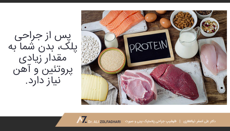 پس از جراحی پلک بدن شما مقداری پروتئین و آهن نیاز دارد