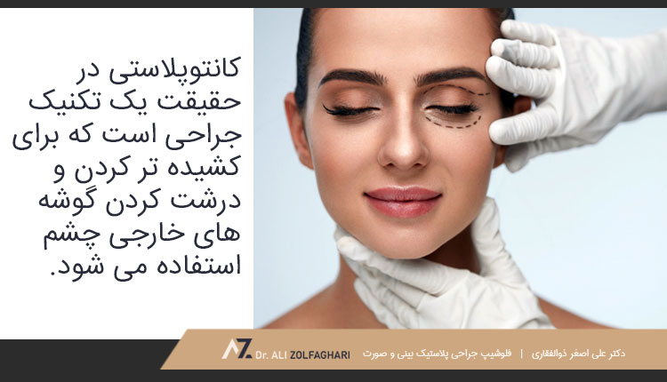 جراحی زیبایی کانتوپلاستی چیست؟