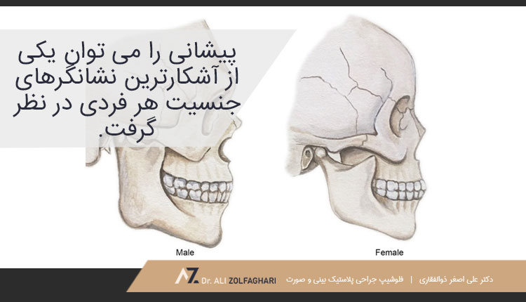تراش استخوان ابرو چیست؟