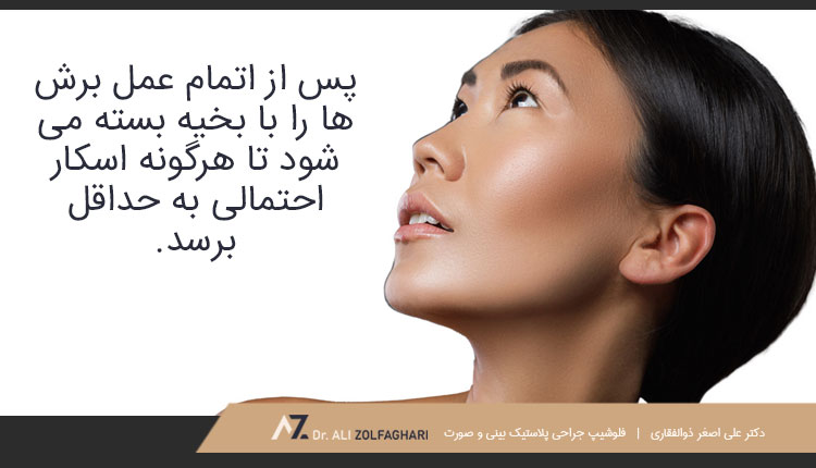 تکنیک تراش استخوان ابرو