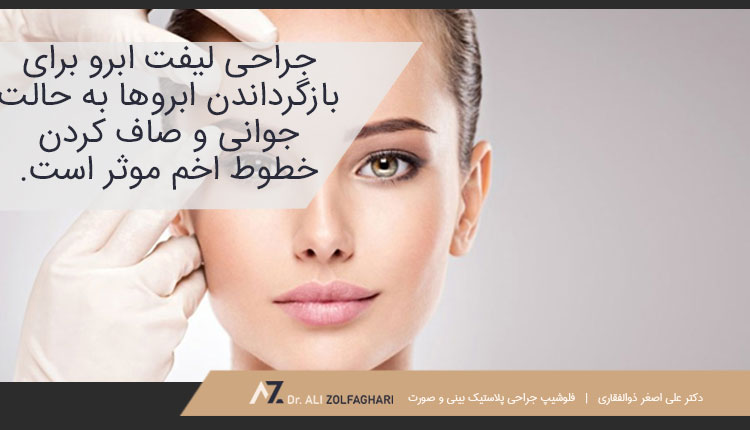 لیفت ابرو چیست؟