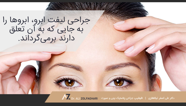 جراحی لیفت ابرو