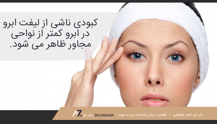 مراقبت های مراحل اولیه ریکاوری لیفت ابرو