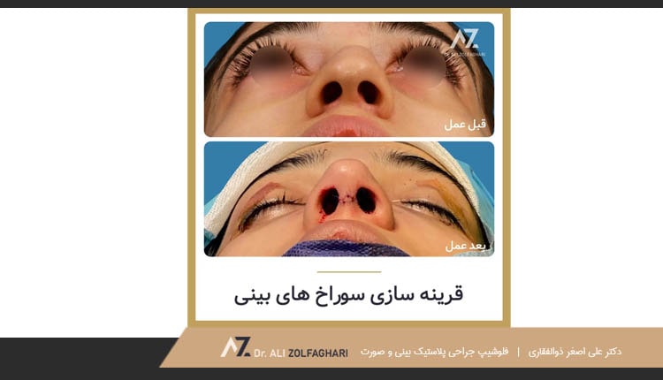 نمونه کار قرینه سازی سوراخ های بینی