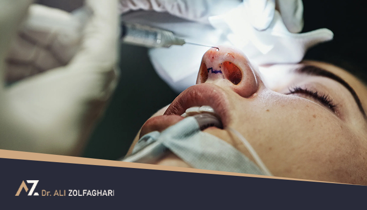 عمل بینی استخوانی | نمونه واقعی قبل و بعد از عمل