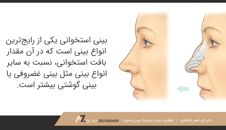 بینی استخوانی و مقایسه با بینی غضروفی یا بینی گوشتی