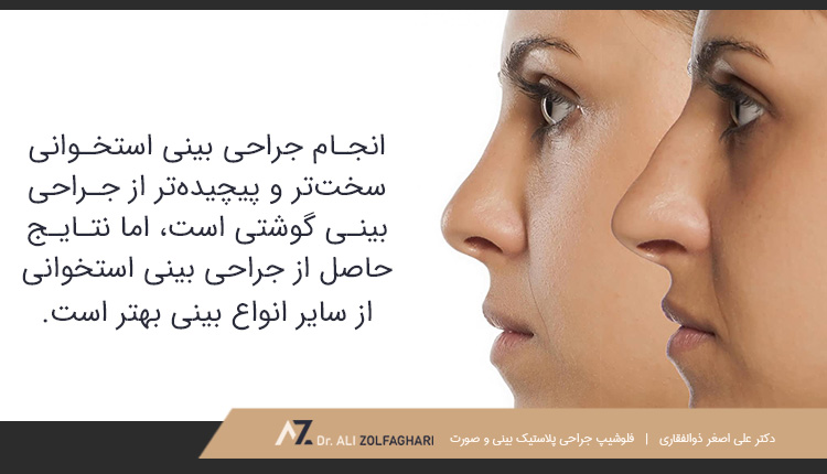 انجام جراحی بینی استخوانی