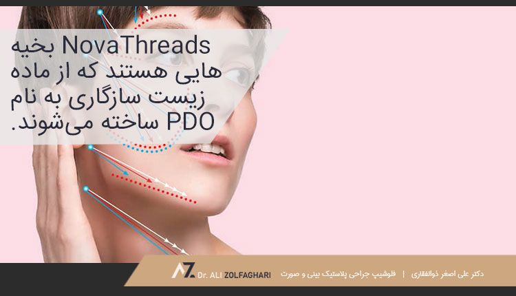 بخیه های NovaThreads در روش لیفت صورت با نخ