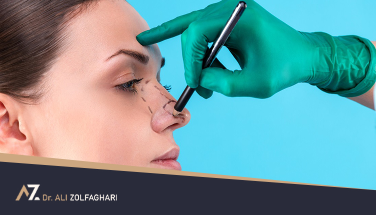 آشنایی با اصلی ترین اقدامات قبل از جراحی بینی