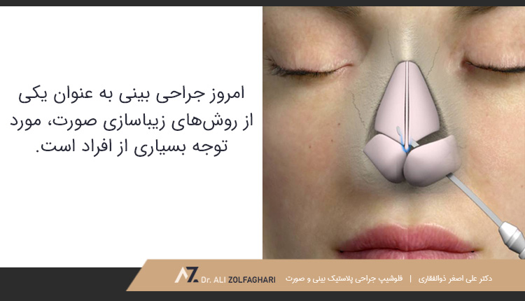 محبوبیت جراحی زیبایی بینی در بین عموم