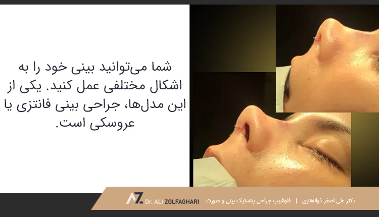 جراحی بینی فانتزی یا عروسکی