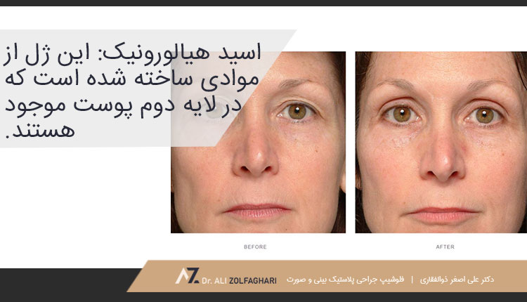 انواع ژل برای لیفت ابرو
