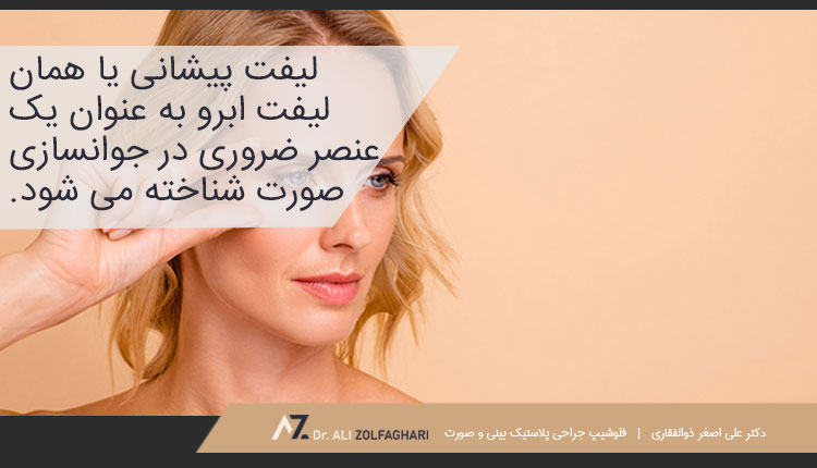 بالا بردن ابرو با اندوتاین