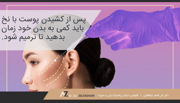 بعد از لیفت با نخ به ناحیه موردنظر دست نزنید