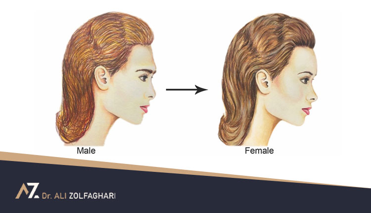 تراش استخوان ابرو چیست