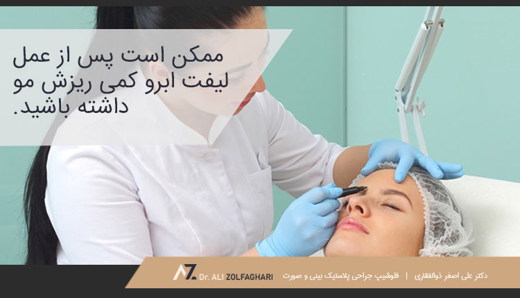 خطرات و عوارض احتمالی جراحی لیفت ابرو