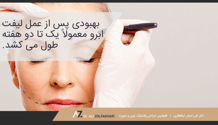 ریکاوری بعد از لیفت ابرو