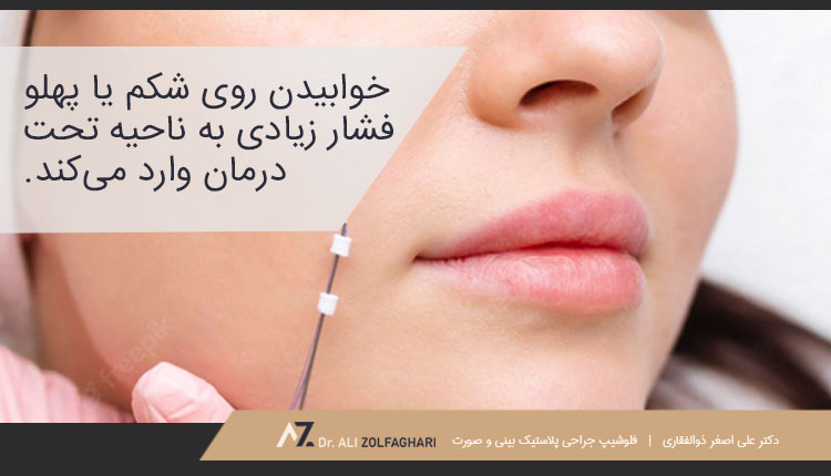 عدم خوابیدن روی شکم یا پهلو بعد از لیفت با نخ