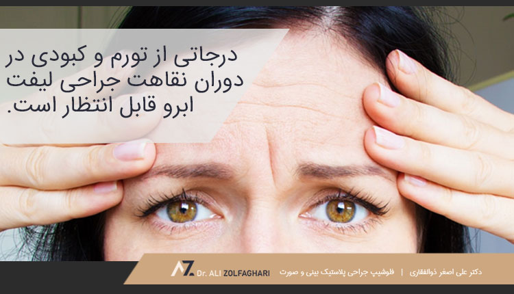 نکات مهم برای مقابله با خطرات و عوارض احتمالی جراحی لیفت ابرو