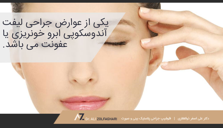 عوارض جانبی لیفت اندوسکوپیک صورت و ابرو