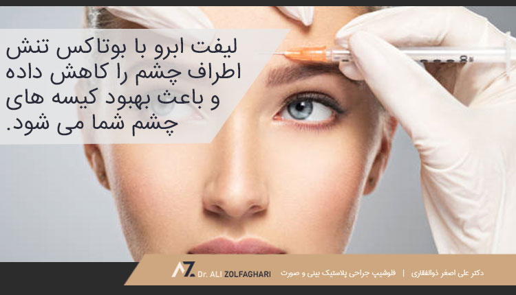 لیفت ابرو با تزریق بوتاکس