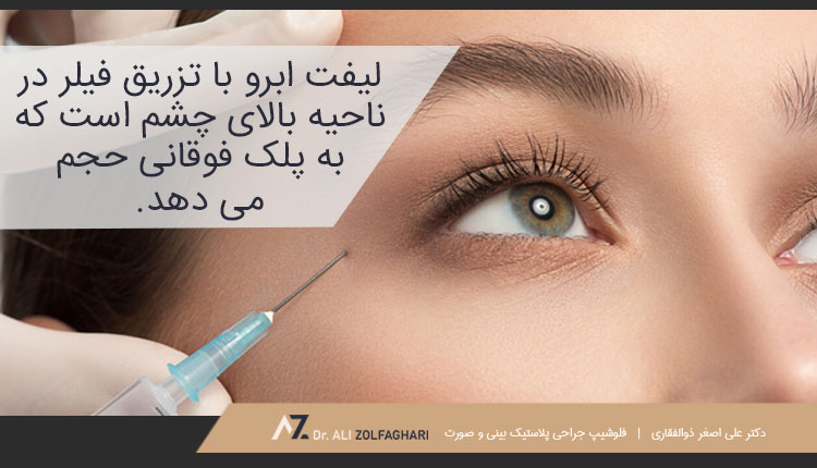 لیفت ابرو با فیلرهای پوستی