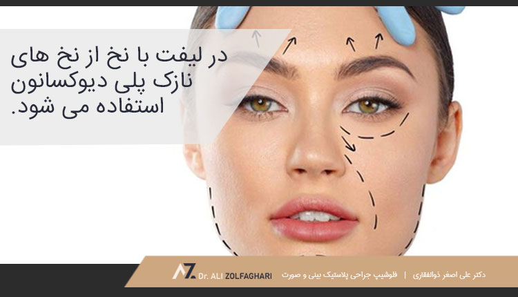 لیفت اَبرو با نخ و چگونگی انجام آن
