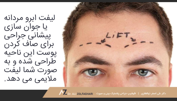 لیفت ابرو مردانه چیست؟