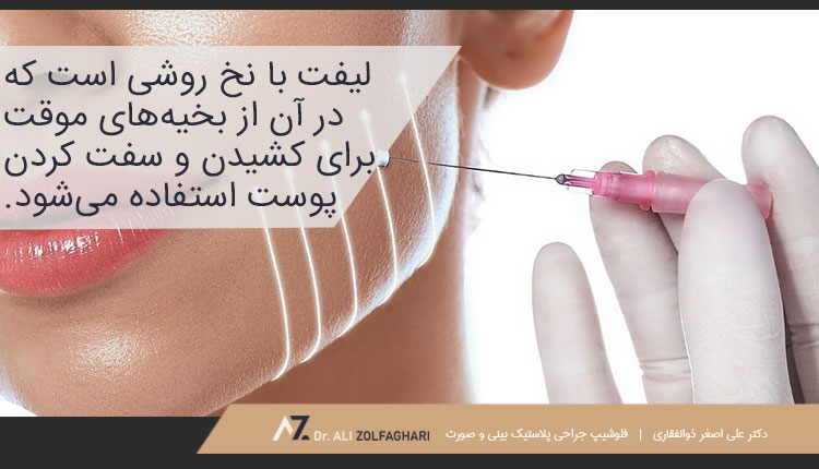 لیفت با نخ