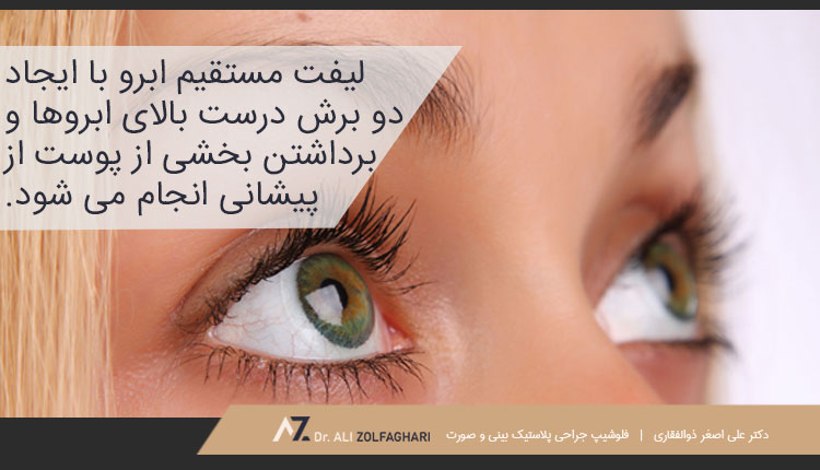 لیفت میانی پیشانی یا لیفت مستقیم ابرو