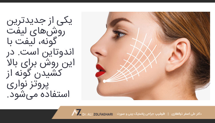 لیفت گونه با اندوتاین