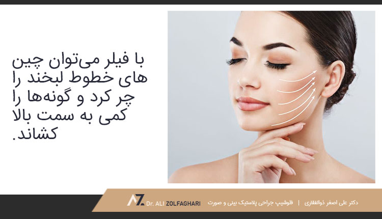 لیفت گونه با فیلر و ژل