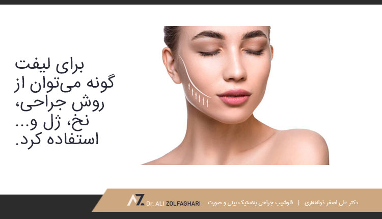 لیفت گونه چیست؟