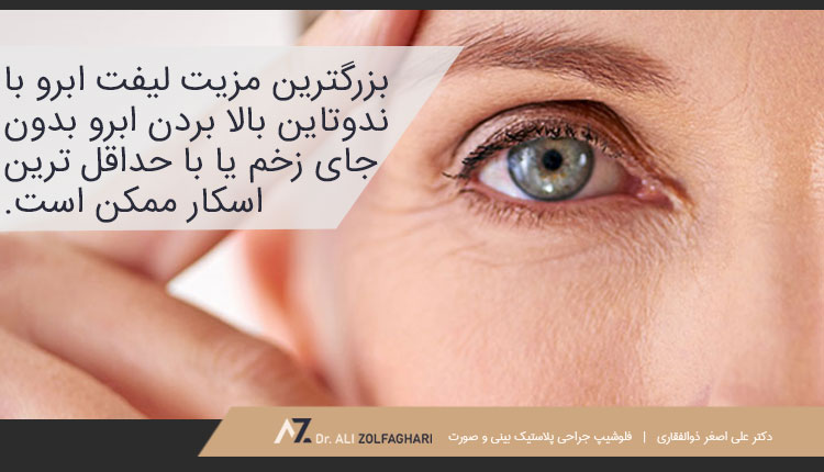 مزیت لیفت ابرو با اندوتاین