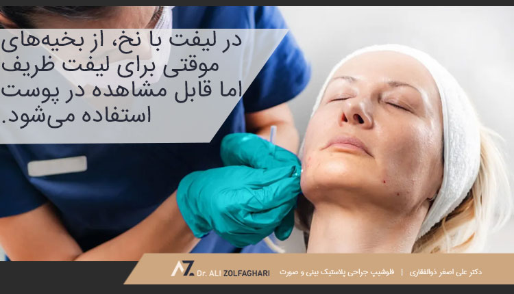 منظور از لیفت صورت با نخ چیست؟