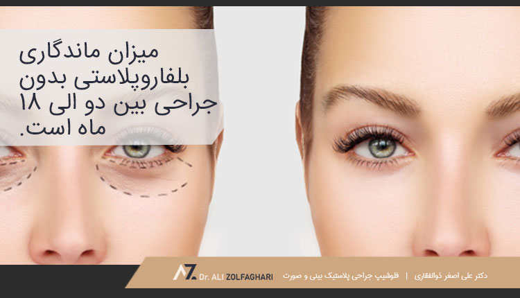میزان ماندگاری بلفاروپلاستی بدون جراحی