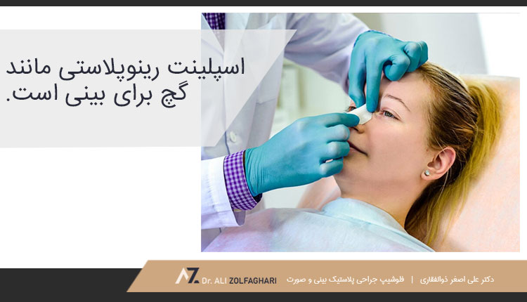 اسپلینت بینی چیست؟