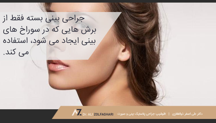 جراحی بسته بینی کج