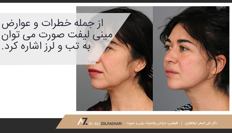 خطرات و عوارض مینی لیفت صورت