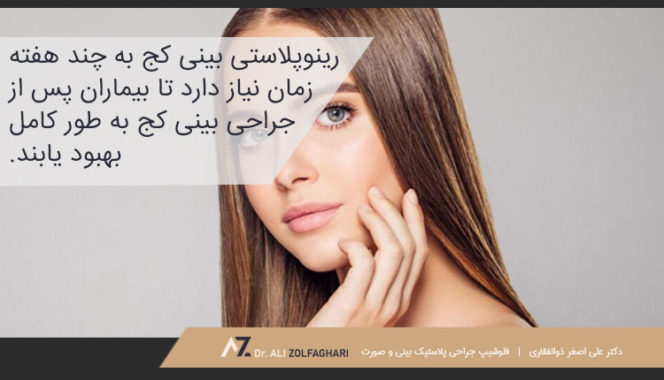 دوران بهبودی بعد از جراحی بینی کج