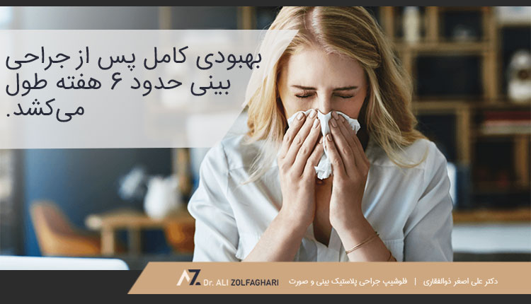 بهبودی کامل پس از عمل بینی چقدر طول می کشد؟