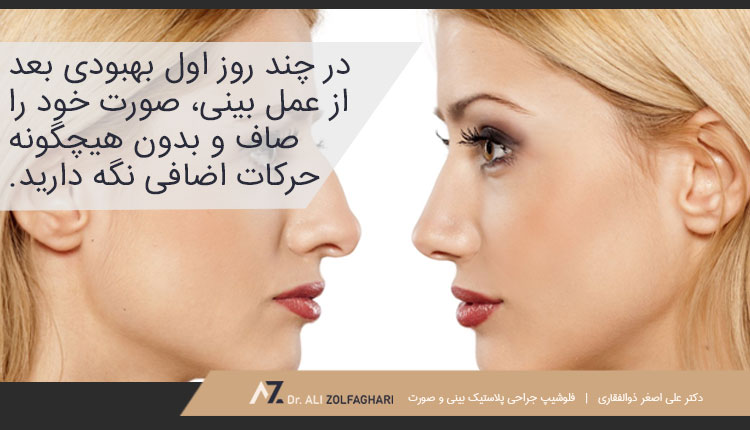 چندروز ابتدایی پس از عمل بینی