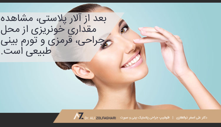 عوارض جانبی آلار پلاستی