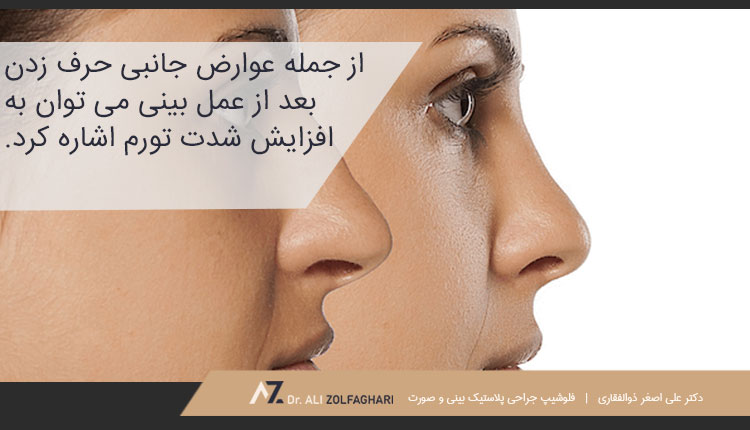 عوارض جانبی حرف زدن بعد از عمل بینی