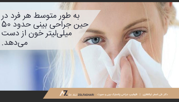 متوسط خونریزی بعد از عمل بینی