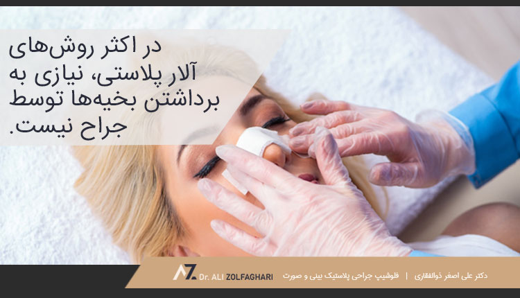 نحوه انجام آلار پلاستی