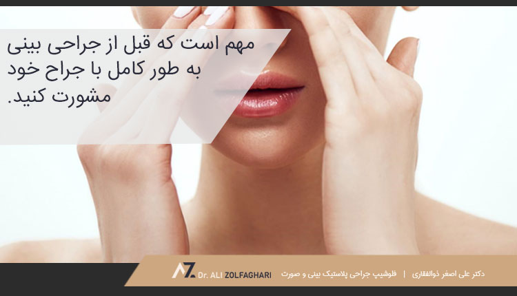 نکات مهم در مورد عمل بینی