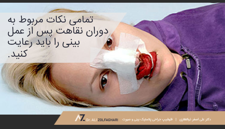 چگونه می‌توان خونریزی پس از جراحی بینی را متوقف کرد؟